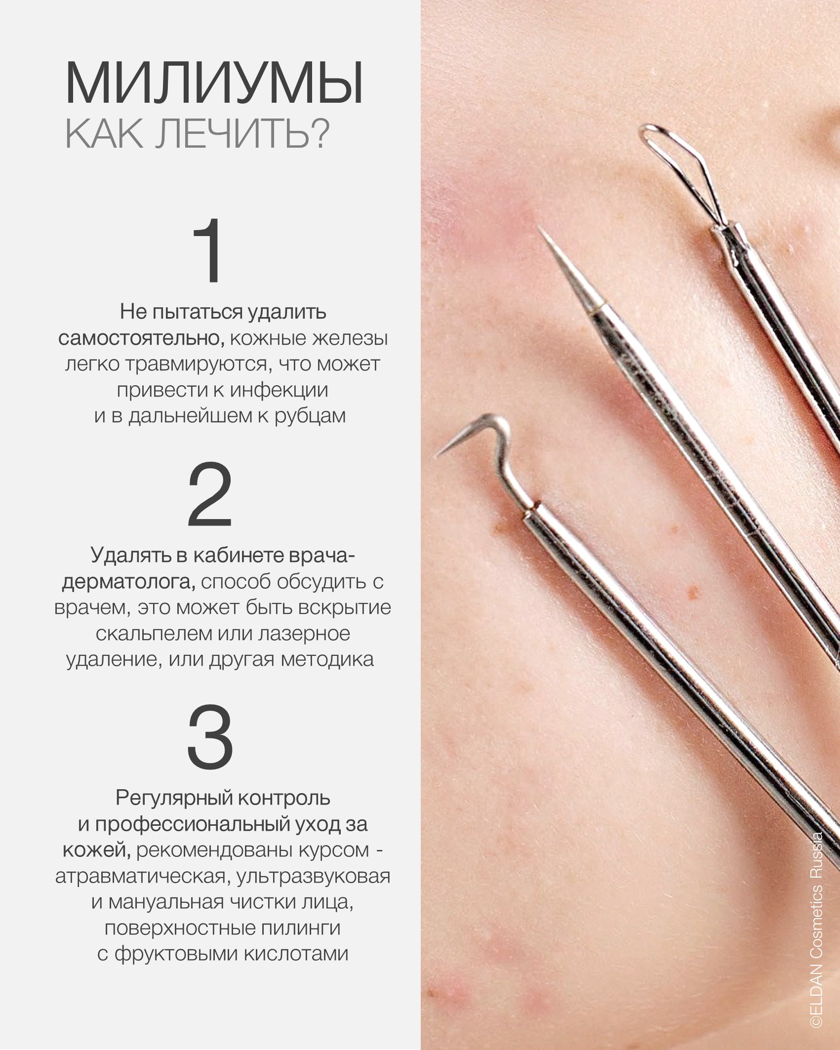 Пост милиумы 4.jpg Пост милиумы 4.jpg